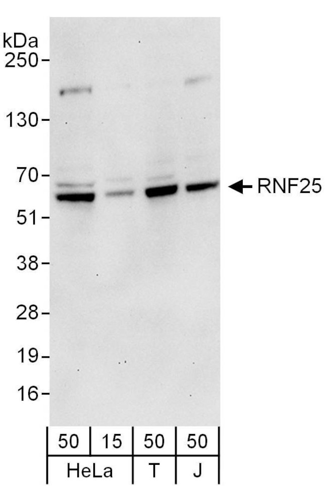 RNF25 Antibody in Western Blot (WB)