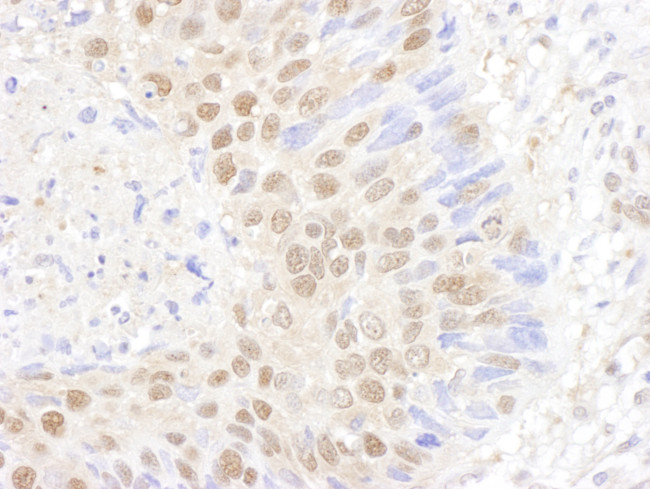 PSMB7 Antibody in Immunohistochemistry (Paraffin) (IHC (P))