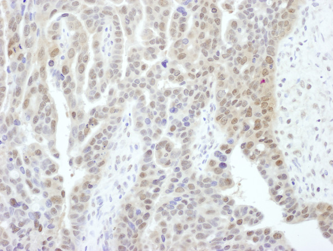 PSMD1 Antibody in Immunohistochemistry (Paraffin) (IHC (P))