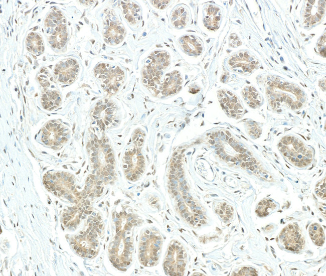 PSMD1 Antibody in Immunohistochemistry (Paraffin) (IHC (P))
