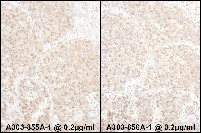 PSMD4 Antibody in Immunohistochemistry (Paraffin) (IHC (P))