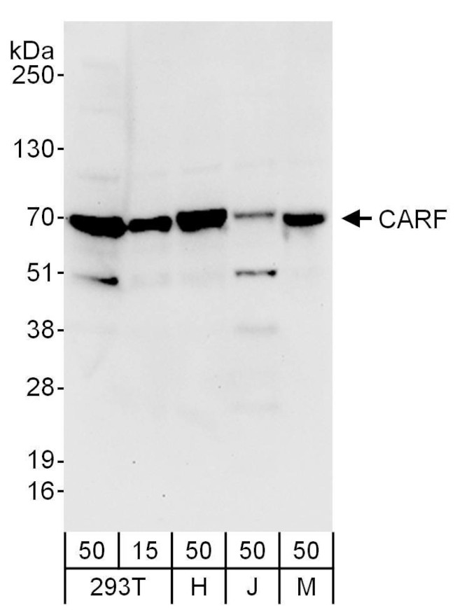 CARF Antibody in Western Blot (WB)