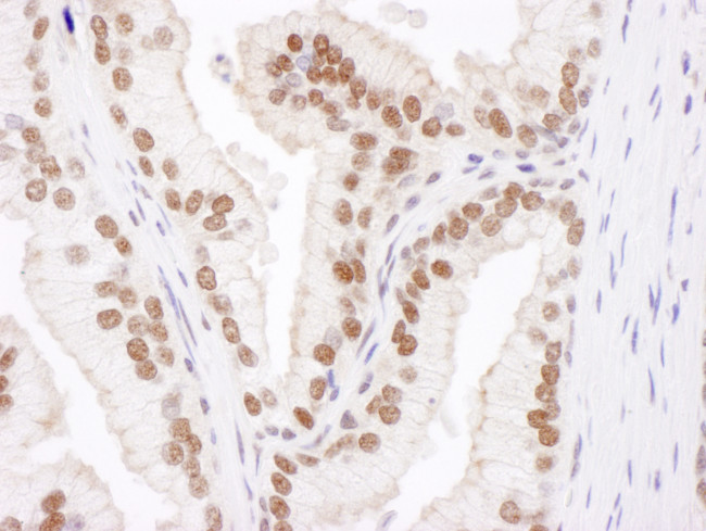 Cul4B Antibody in Immunohistochemistry (Paraffin) (IHC (P))