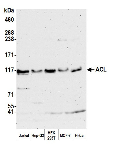 ACL Antibody in Western Blot (WB)