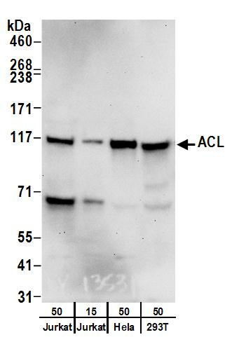 ACL Antibody in Western Blot (WB)