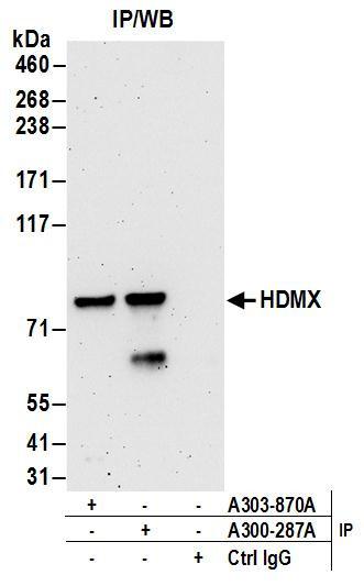 HdmX/MDM4 Antibody in Immunoprecipitation (IP)