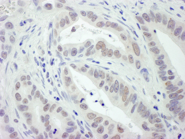 RPA32 Antibody in Immunohistochemistry (Paraffin) (IHC (P))