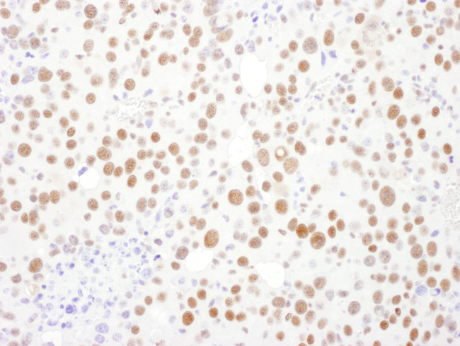 PSME3 Antibody in Immunohistochemistry (Paraffin) (IHC (P))