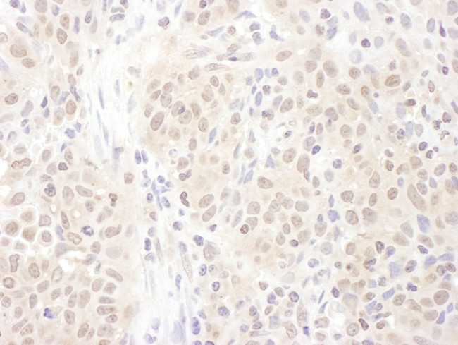 PSME4 Antibody in Immunohistochemistry (Paraffin) (IHC (P))