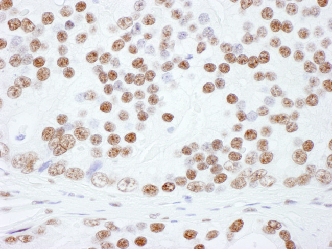 hnRNP-L Antibody in Immunohistochemistry (Paraffin) (IHC (P))