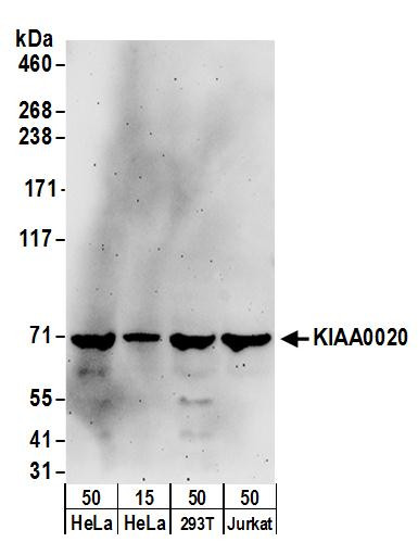 KIAA0020 Antibody in Western Blot (WB)