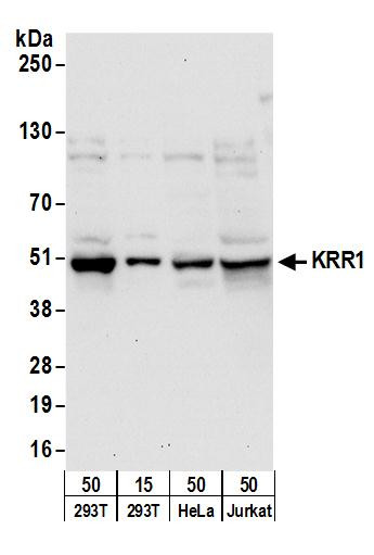 KRR1 Antibody in Western Blot (WB)