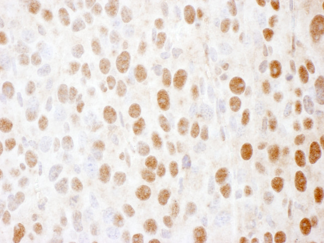 SS-B Antibody in Immunohistochemistry (Paraffin) (IHC (P))