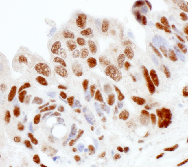 SS-B Antibody in Immunohistochemistry (Paraffin) (IHC (P))