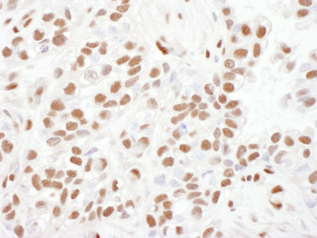 53BP1 Antibody in Immunohistochemistry (Paraffin) (IHC (P))