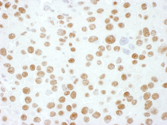 hnRNP M3/4 Antibody in Immunohistochemistry (Paraffin) (IHC (P))