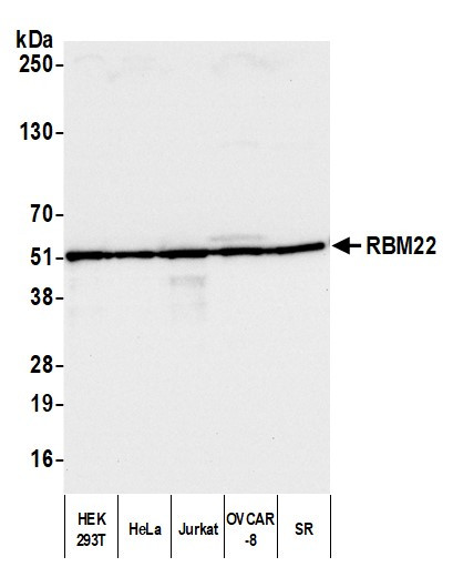 RBM22 Antibody in Western Blot (WB)