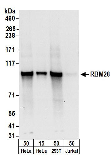RBM28 Antibody in Western Blot (WB)