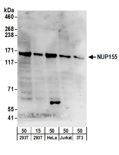 NUP155 Antibody in Western Blot (WB)