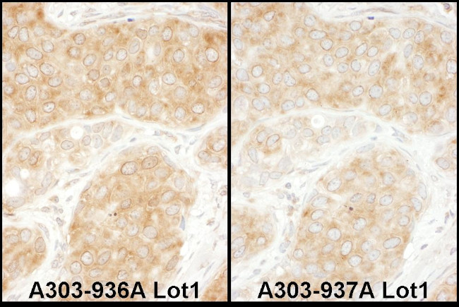 RPS11 Antibody in Immunohistochemistry (Paraffin) (IHC (P))