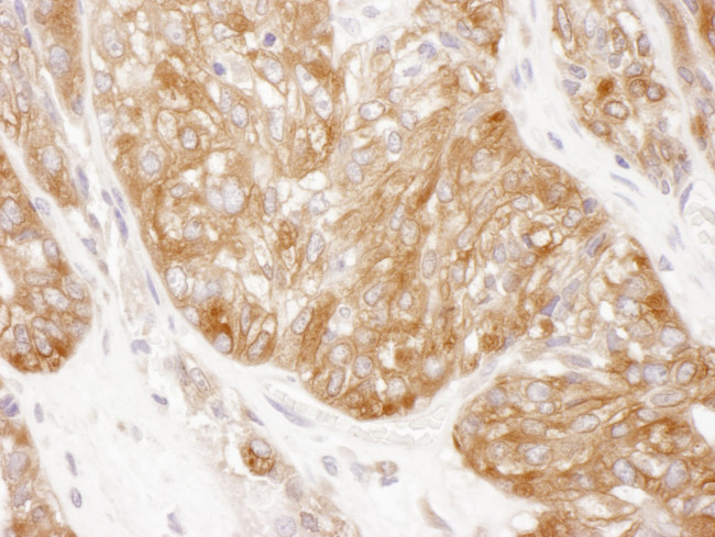 SERBP1 Antibody in Immunohistochemistry (Paraffin) (IHC (P))