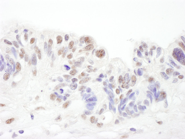 SNRPA1 Antibody in Immunohistochemistry (Paraffin) (IHC (P))