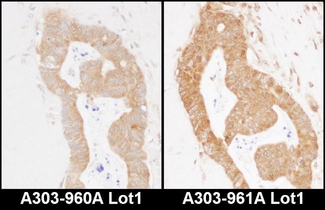 MARS Antibody in Immunohistochemistry (Paraffin) (IHC (P))
