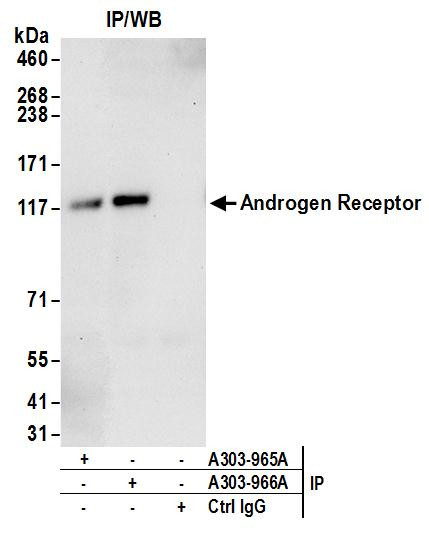 Androgen Receptor Antibody in Immunoprecipitation (IP)