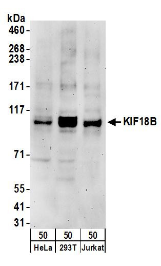 KIF18B Antibody in Western Blot (WB)
