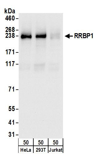 RRBP1 Antibody in Western Blot (WB)