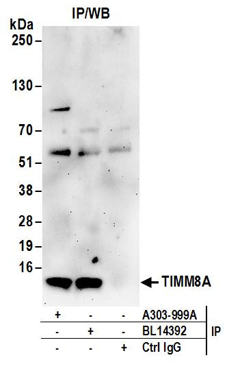 TIMM8A Antibody in Immunoprecipitation (IP)