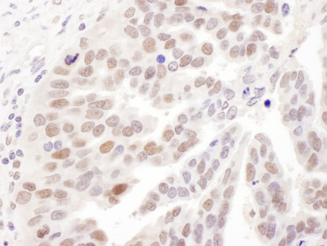 PolD1 Antibody in Immunohistochemistry (Paraffin) (IHC (P))