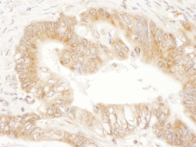 CaMKK2 Antibody in Immunohistochemistry (Paraffin) (IHC (P))
