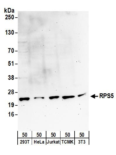 RPS5 Antibody in Western Blot (WB)