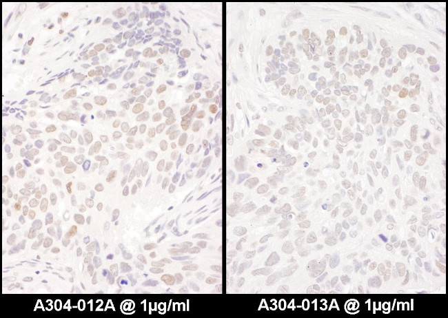 DENTT Antibody in Immunohistochemistry (Paraffin) (IHC (P))