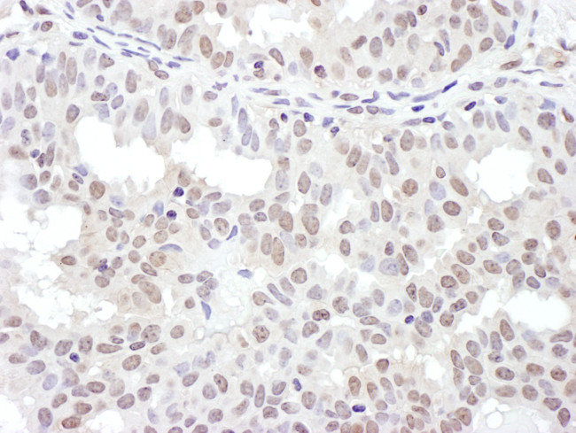 NRF Antibody in Immunohistochemistry (Paraffin) (IHC (P))