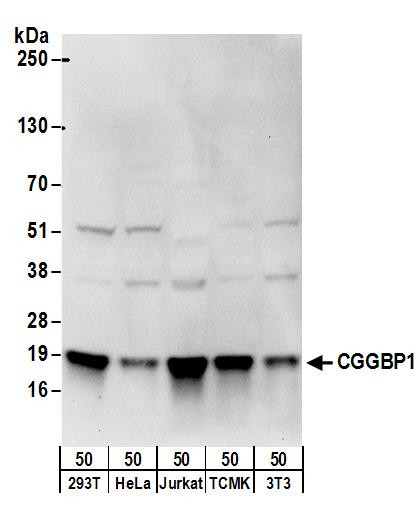 CGGBP1 Antibody in Western Blot (WB)