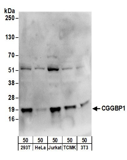 CGGBP1 Antibody in Western Blot (WB)