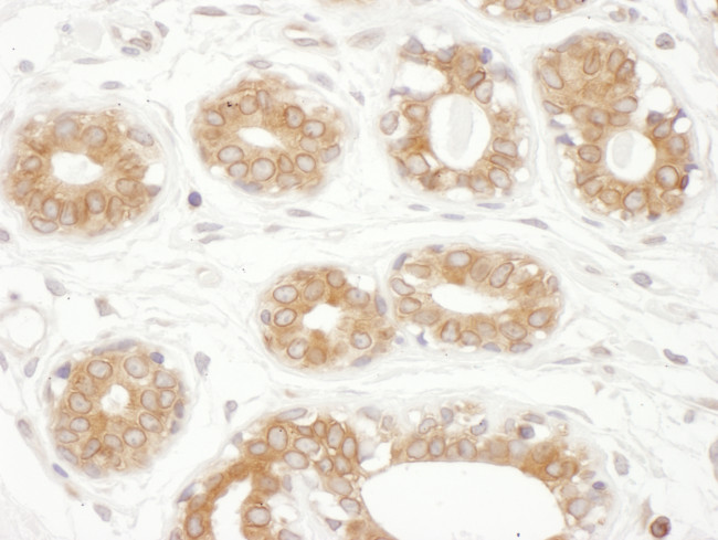 TMX1 Antibody in Immunohistochemistry (Paraffin) (IHC (P))