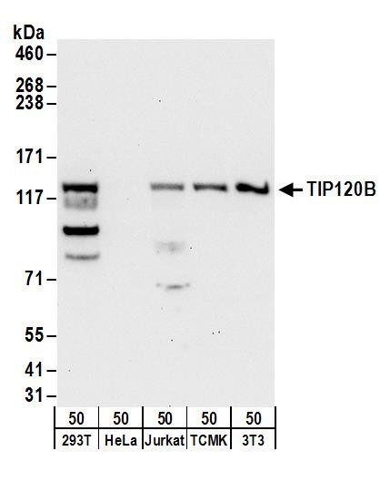 TIP120B Antibody in Western Blot (WB)