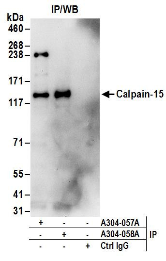 Calpain-15 Antibody in Immunoprecipitation (IP)
