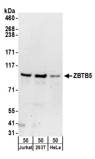 ZBTB5 Antibody in Western Blot (WB)