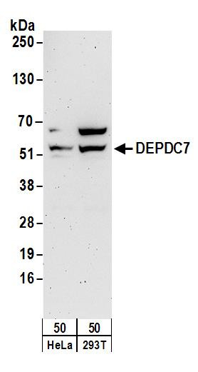 DEPDC7 Antibody in Western Blot (WB)