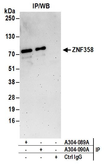ZNF358 Antibody in Immunoprecipitation (IP)