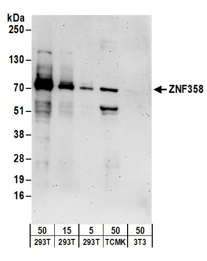 ZNF358 Antibody in Western Blot (WB)