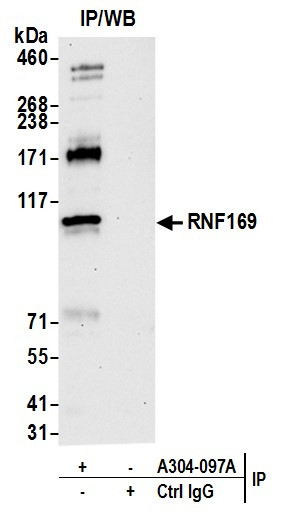 RNF169 Antibody in Immunoprecipitation (IP)
