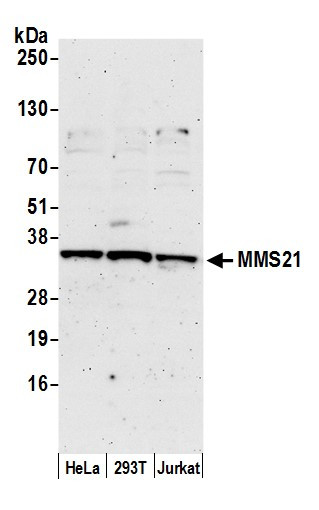 MMS21 Antibody in Western Blot (WB)