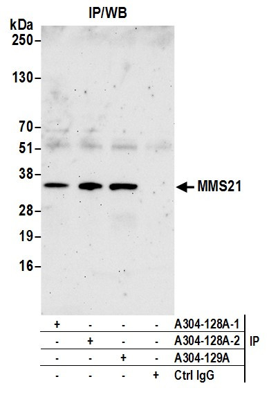 MMS21 Antibody in Immunoprecipitation (IP)
