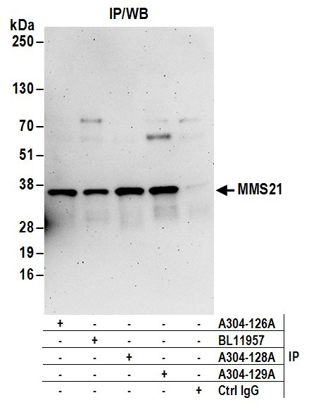 MMS21 Antibody in Immunoprecipitation (IP)