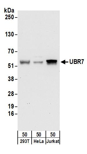 UBR7 Antibody in Western Blot (WB)